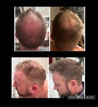 Charger l'image dans la galerie, Système IR Clinical