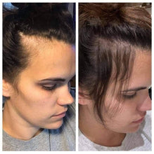 Charger l'image dans la galerie, Système IR Clinical